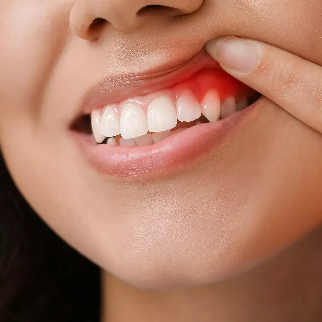 Eine Frau hält sich mit schmerzendem Zahn die Hand vor den Mund.